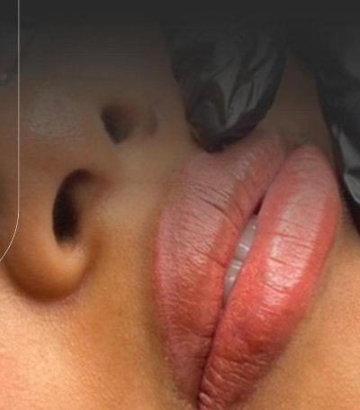 Neutralização Labial Soft